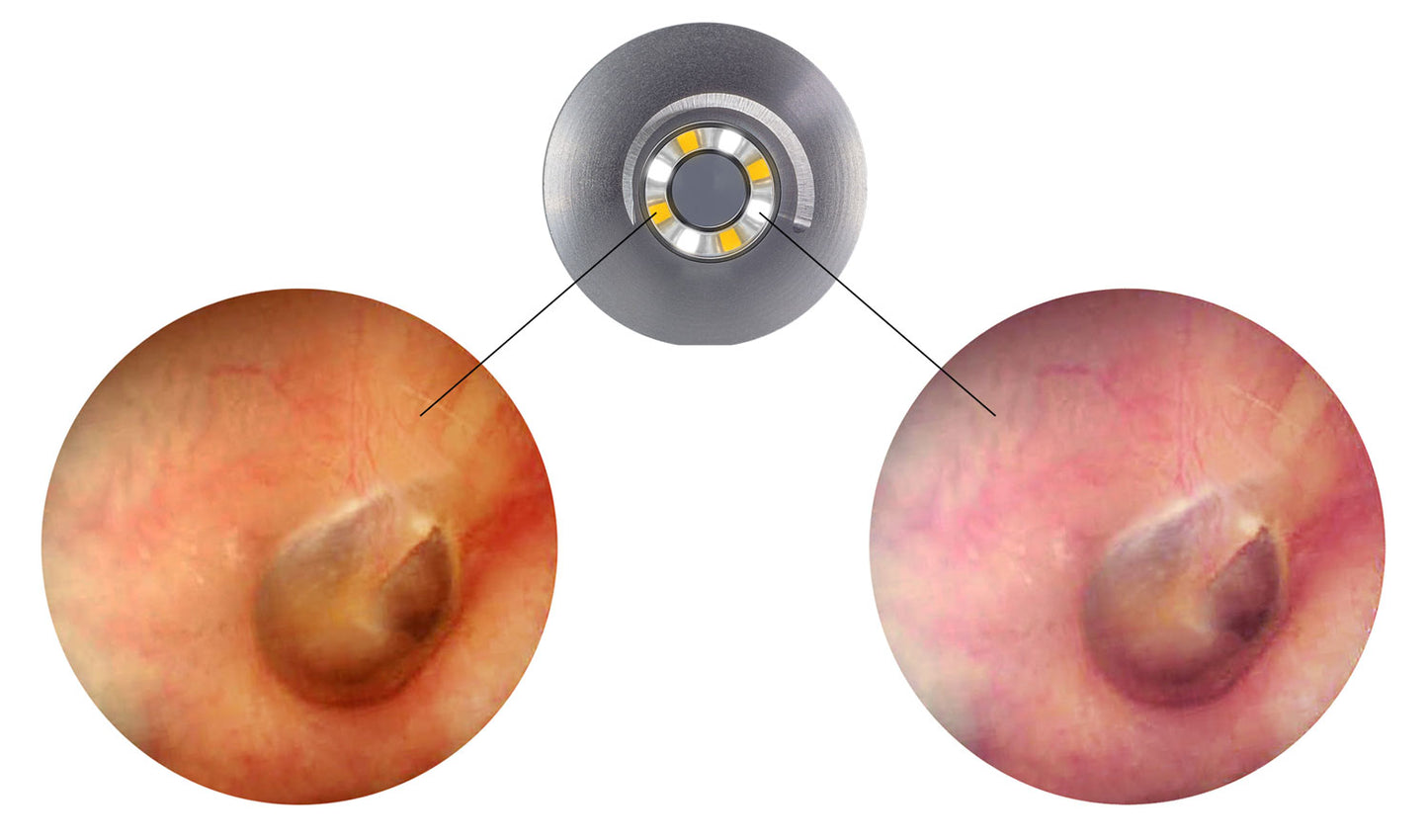 LuxaScope Auris CCT LED 2.5 V | Otoscope
